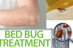 Best Bed Bug Treatment